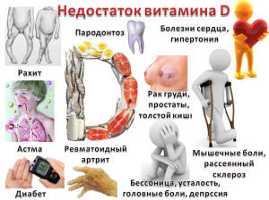 Симптомы недостатка витамина D