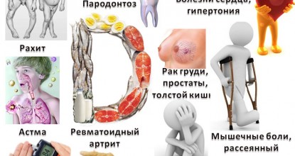 Симптомы дефицита витамина D