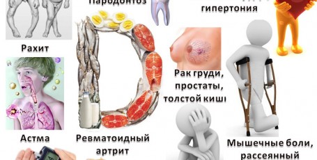 Симптомы дефицита витамина D